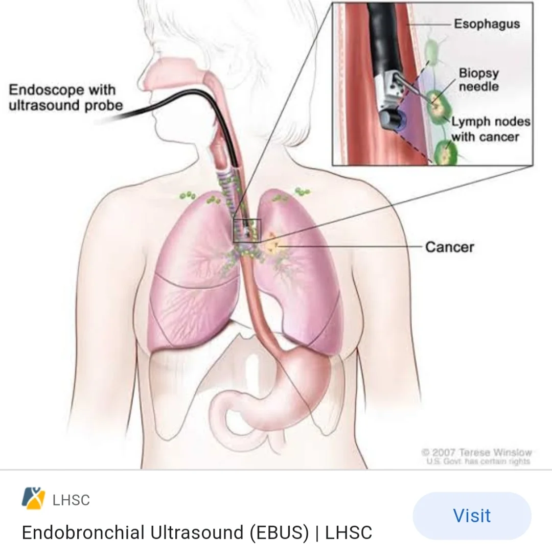 Follow-up care image