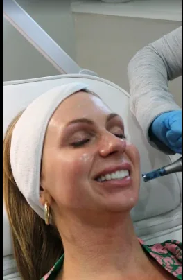 PRP Therapy image