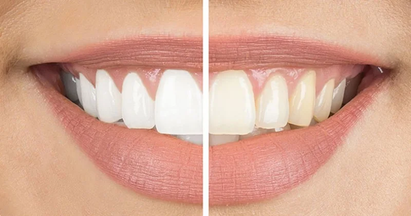 Cosmetic Dentistry image