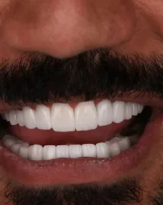Cosmetic Dentistry image