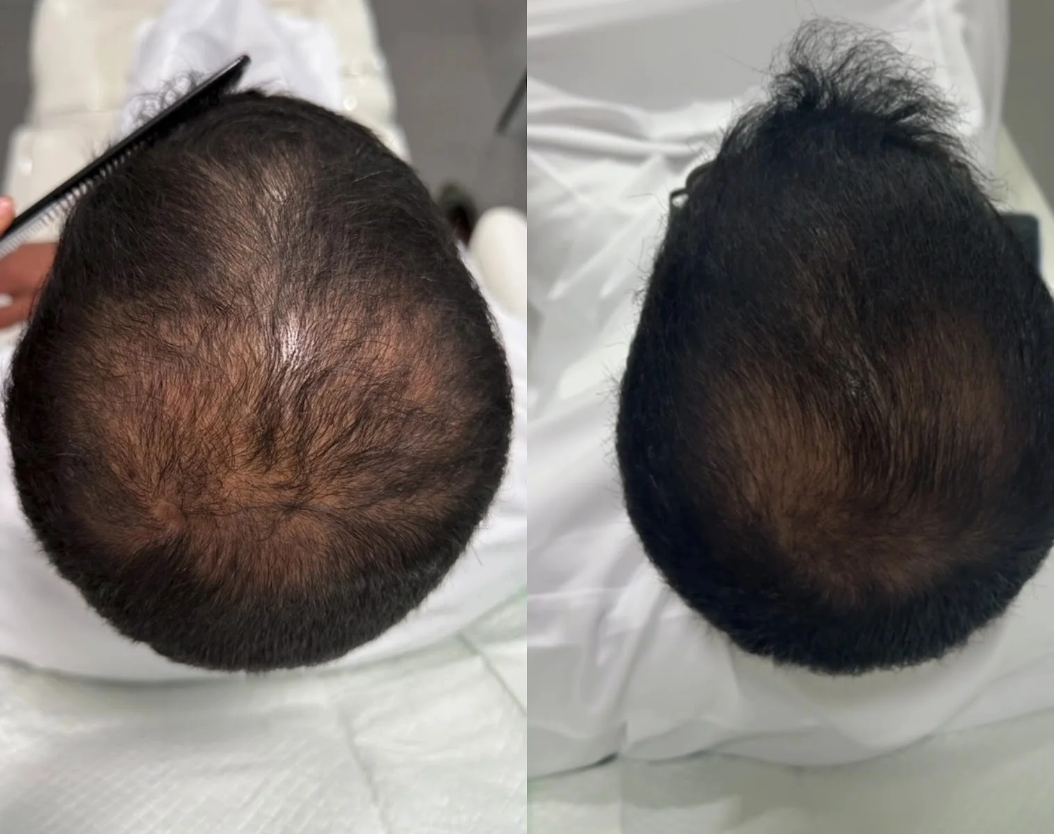 Scar Revision & Aesthetic Scar Management image