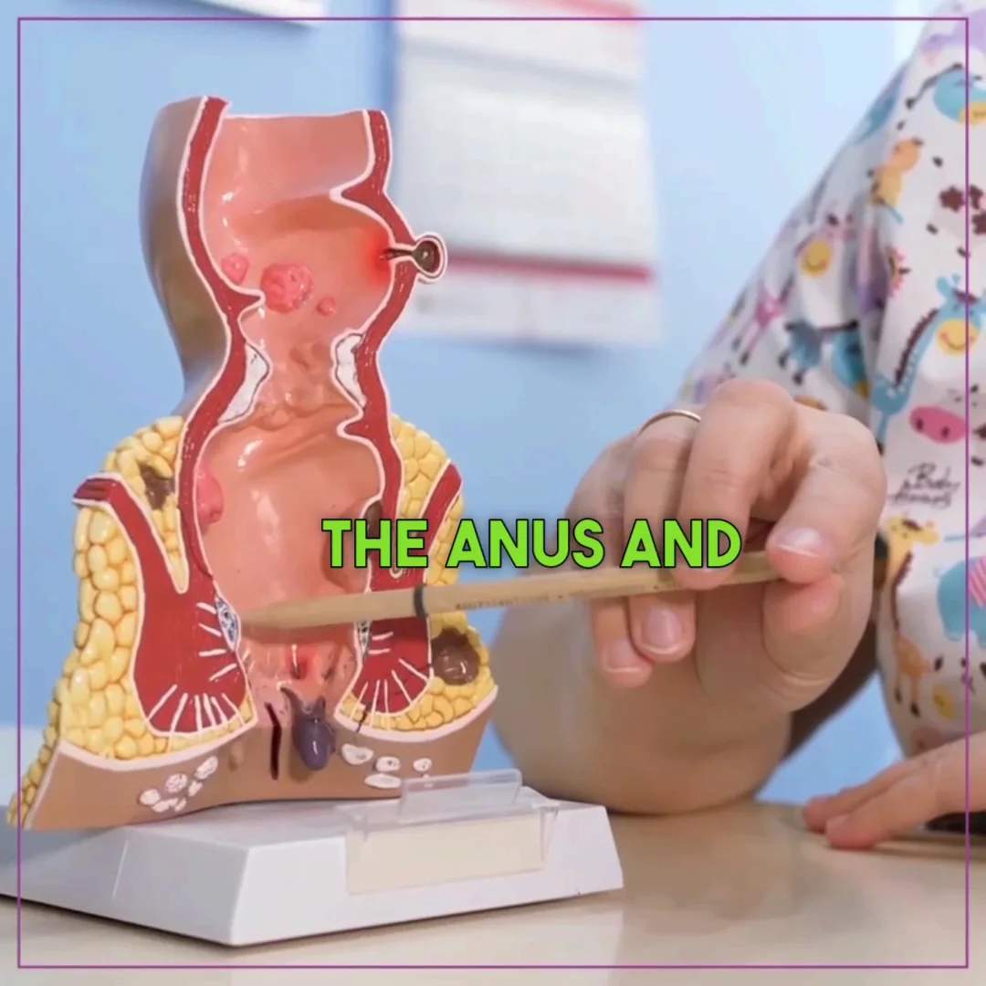 Laser Hemorrhoid Treatment (where suitable) image
