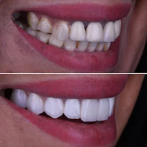 Cosmetic Dentistry image