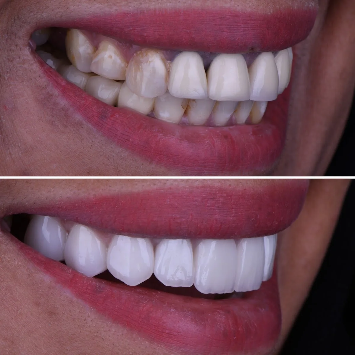 Prosthodontics image